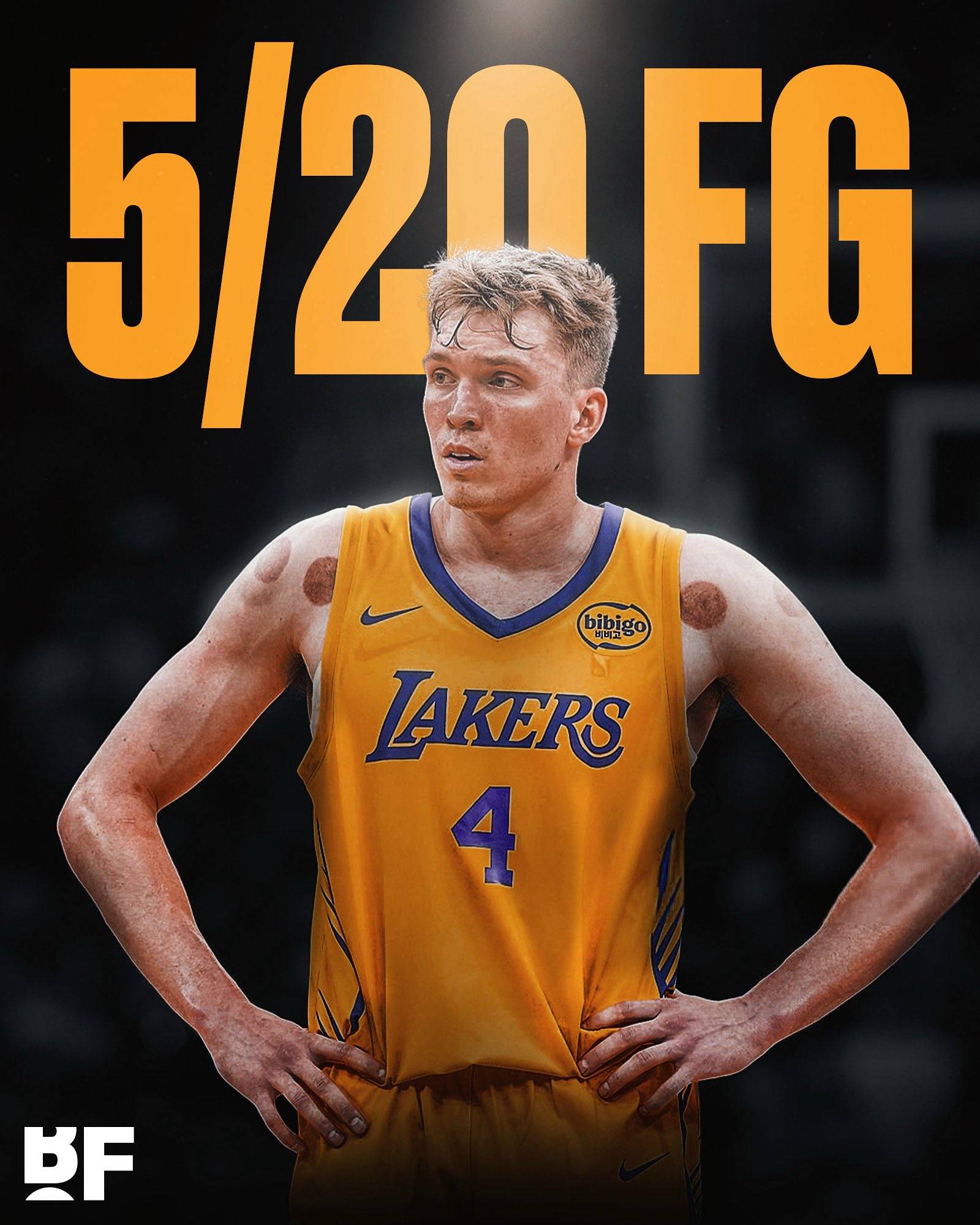 洛杉矶湖人赛后遗憾出局，志在意甲名次提升，引发热议，心理建设被强调的简单介绍